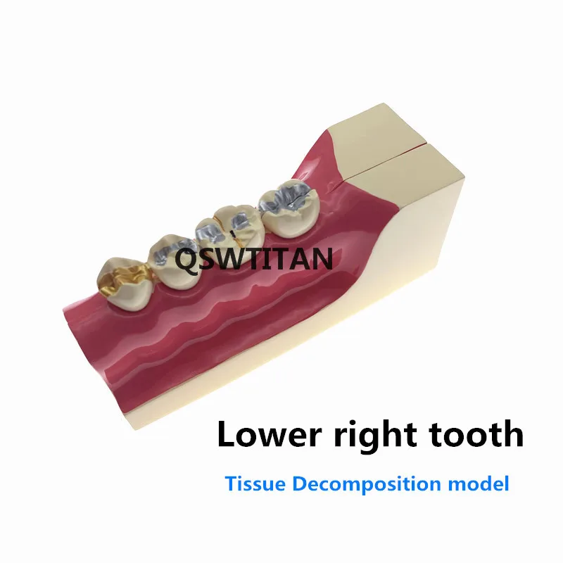 Модель поперечного сечения моляра при заболеваниях зубов Модель для изучения анатомии зубов