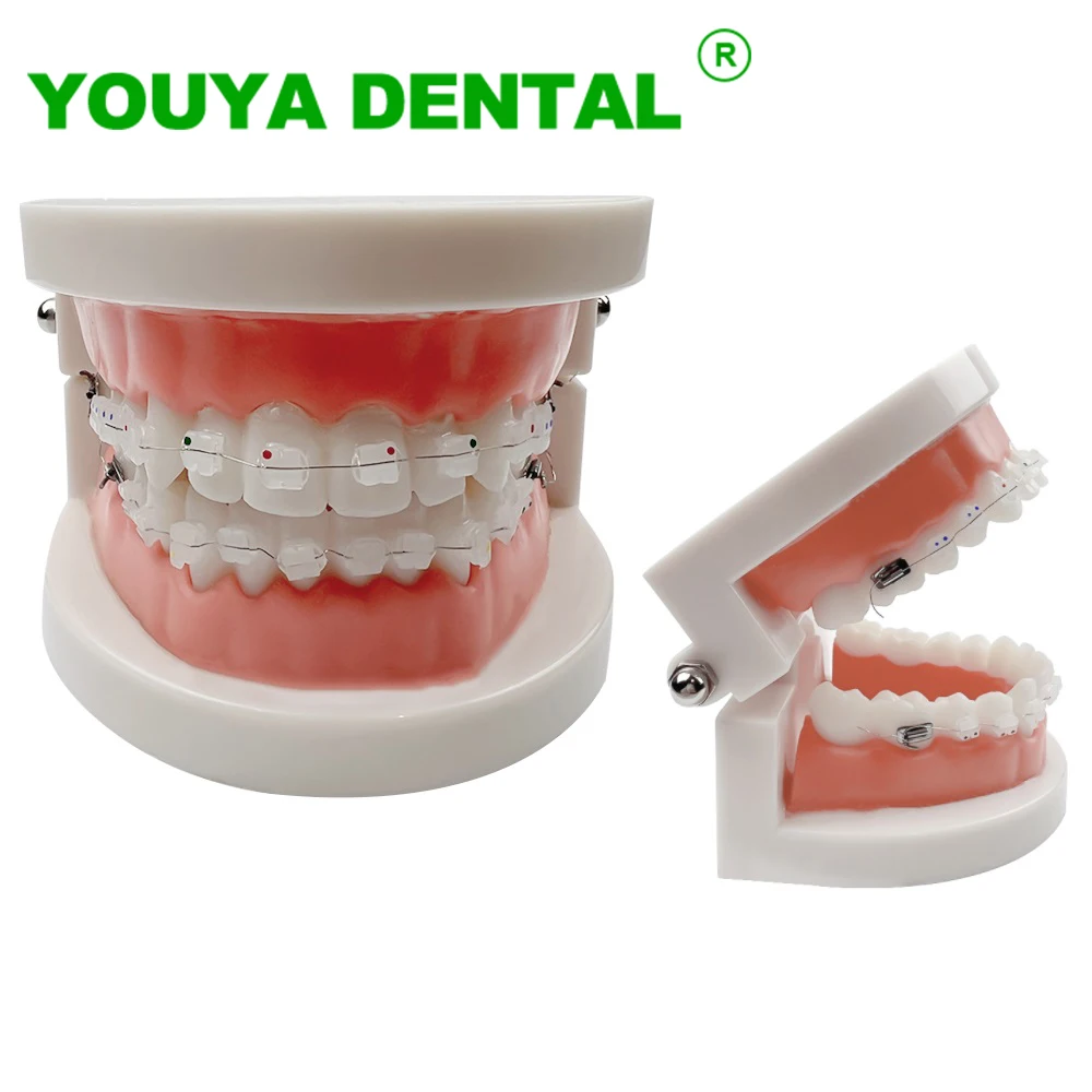 Образовательная модель Стоматолога, модель ортодонтического лечения зубов с керамическими брекетами, демонстрационные модели стоматологии для общения с пациентами